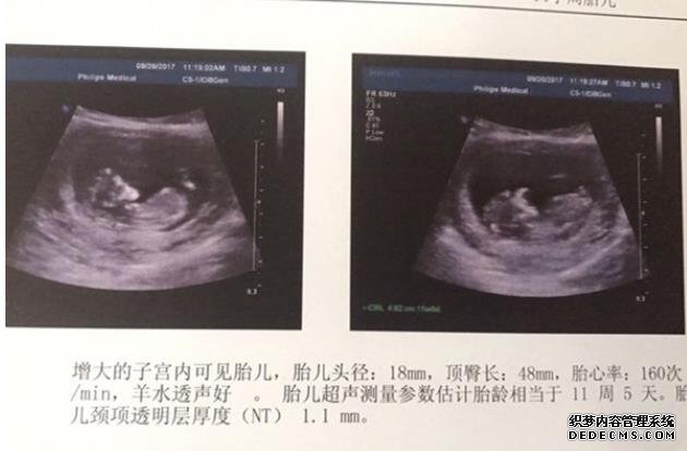 2022年湖北失独家庭60岁补贴标准 湖北妇幼供精试管流程 ‘为什么16zqb超看到了女孩的两条线，最后生了男孩呢？’