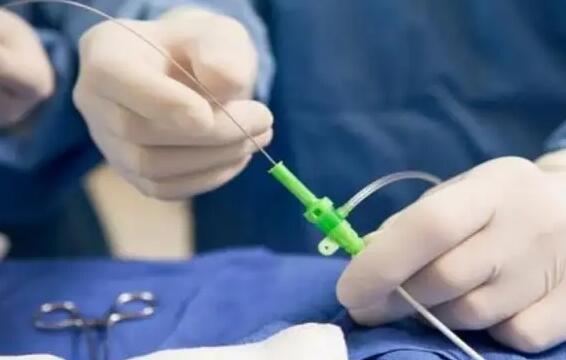 杭州代生中介靠谱吗 在杭州妇保做试管成功率的高的人群: ‘用酒精测试男女图片’