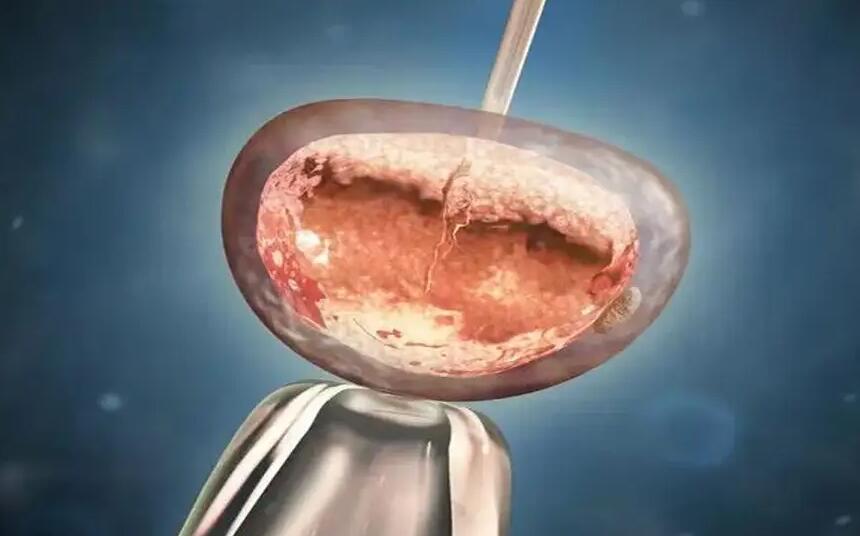 北京301医院试管婴儿是第三代试管吗 北京大学人民医院可以借卵做供卵试管吗 ‘孕妇B超女孩几率有哪些特征’