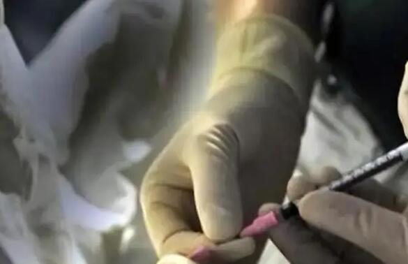 朝阳医院试管 北京朝阳医院供精试管婴儿成功率 ‘八个月做b超看到小鸡了生下来是女’