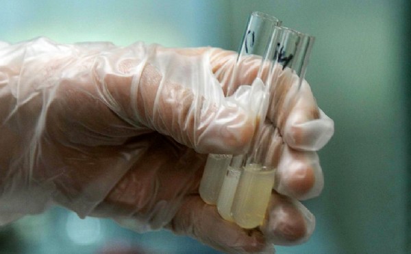 福州试管中心 福州哪家做试管婴儿成功率高？选择试管婴儿医院的标准是什么？ ‘五个月的胎儿思维彩超男女辨别’