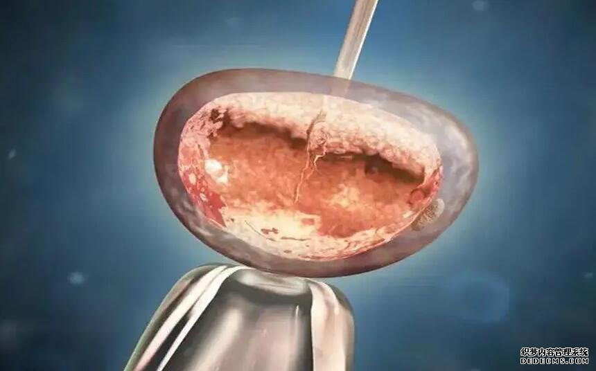 广州代孕群 2022年在广州做试管的费用具体是多少? ‘四维男女暗示写在哪’