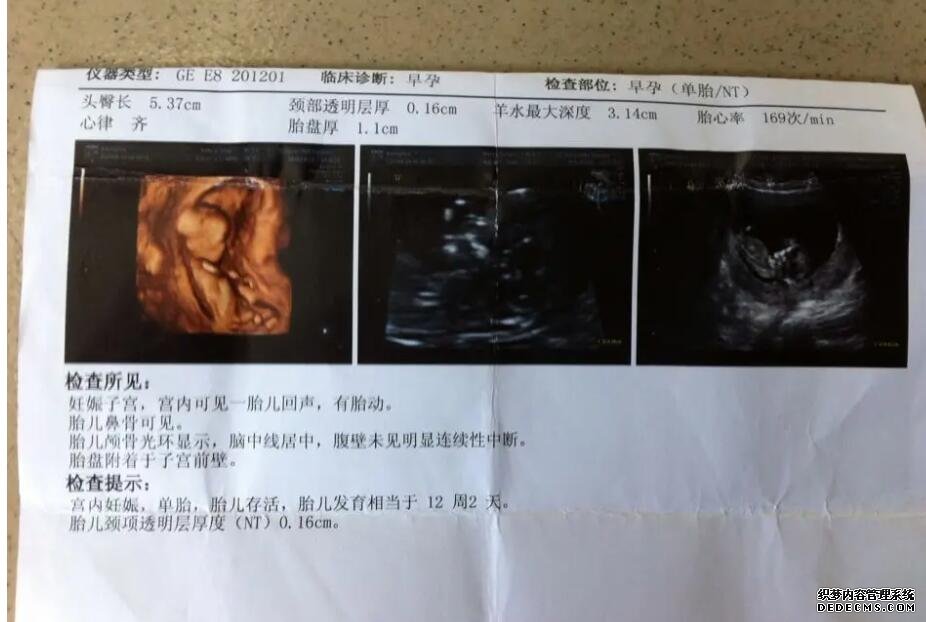 河北洗精 河北十大试管医院排名河北做试管的医院排名 ‘17周查b超查男女准确率高吗’