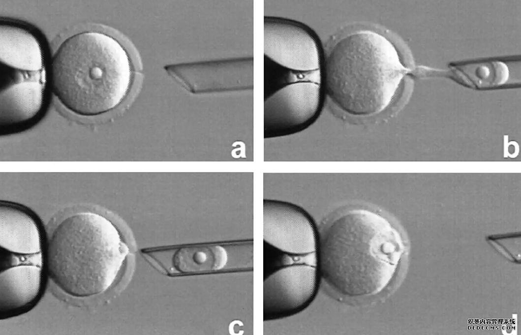 杭州供卵试管资讯 杭州不孕不育的医生推荐。 ‘用浓度为95%的酒精测男女,怎么测最准确?’