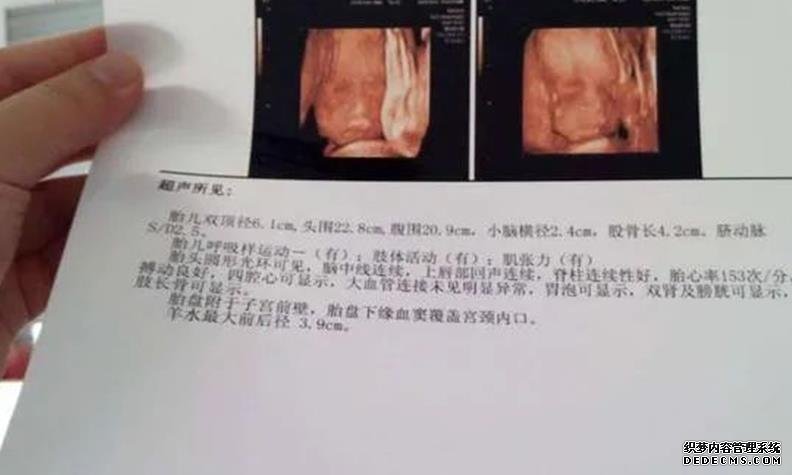 2022解放军总医院第一医学中心试管婴儿成功率一览，附试管婴儿成功率预估表-国内拉拉试管婴儿机构