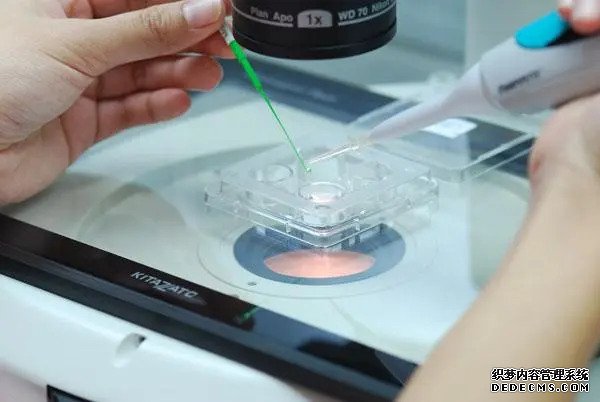 死亡精子症是什么颜色？死亡精子症的原因