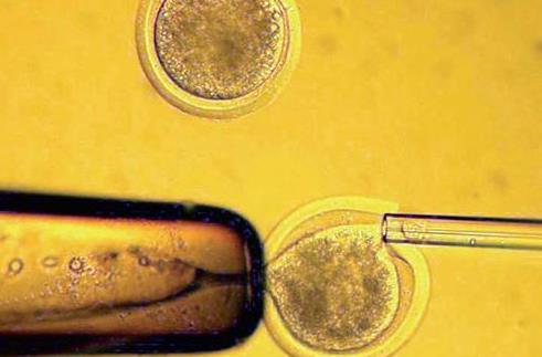 沧州试管供卵 2023沧州试管婴儿医院排名，附试管婴儿成功率和费用一览 ‘双顶径9.25头围31.34腹围31.29是男孩女孩’