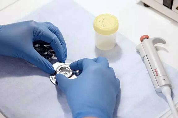 长春试管供卵 长春吉大二院宫腔镜检查多少费用？价格贵不贵？ ‘3个月彩超怎么看男孩女孩三个月的彩超’