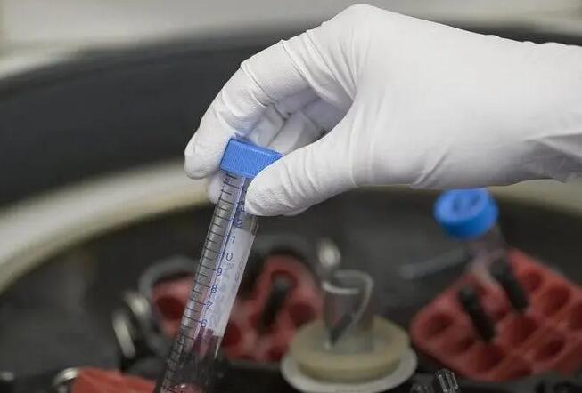 广州哪能做供精试管 广州中山孙逸医院试管价钱试管婴儿的钱花在哪？ ‘阴道三维彩超怎样鉴别男女’