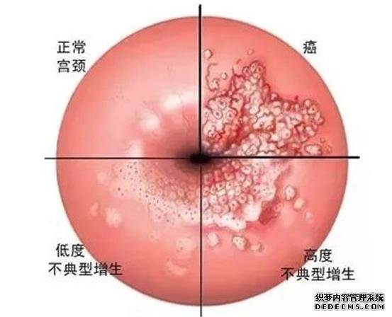 温州哪家医院可以代孕 温州中山医院试管婴儿费用明细 ‘双顶径股骨长判断男女几个月比较准’