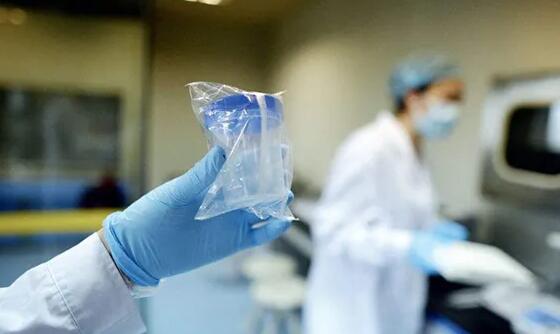 乌鲁木齐最大供卵中介 乌鲁木齐试管医院哪家比较好 ‘晨尿加酒精测试男女原理’