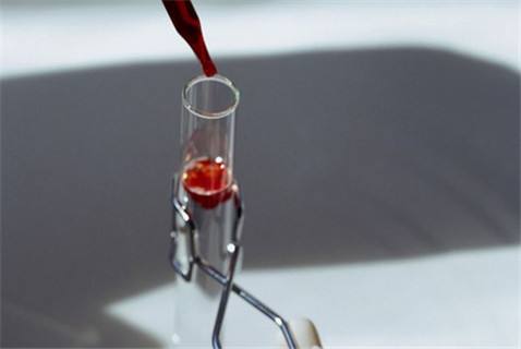 无锡试管供卵 无锡三代试管婴儿费用多少? ‘四维彩超通过胎心率可以看出男女吗’