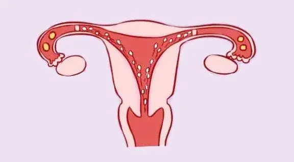 试管婴儿胚胎选哪种好?移植哪种胚胎比较好?