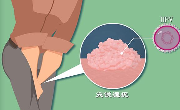 高龄备孕,试管婴儿如何确保优生优育?