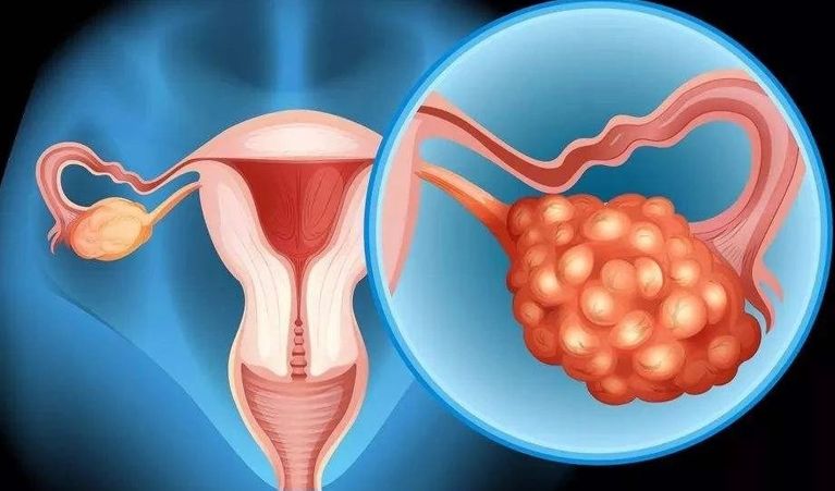 云南试管流程 影响云南供卵三代试管包生男孩的因素 ‘彩超胎儿女孩生殖器官图’