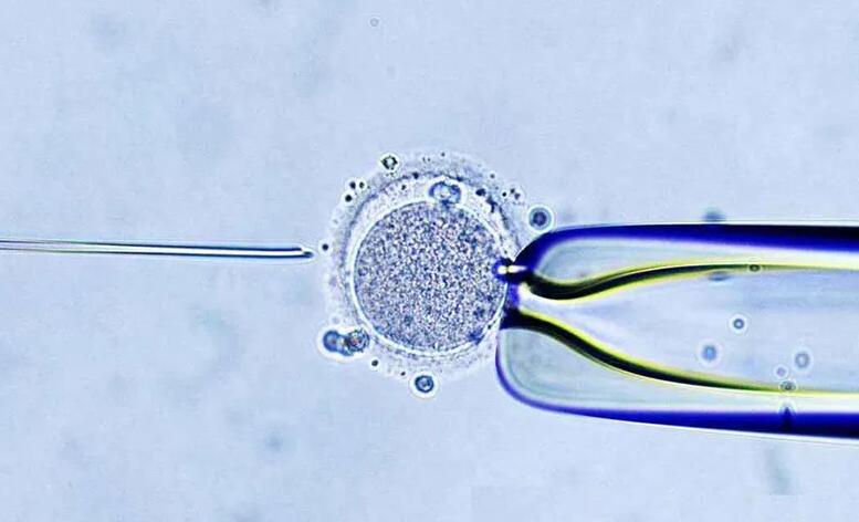 衢州供卵试管 衢州妇幼保健院推荐理由 ‘怀孕生男孩的症状大腿根’