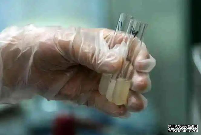 输卵管堵塞是怎么引起的？帮你找出了6大诱因，女性值得深思！-北医三院试管婴儿详细流程2020