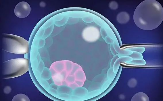 1692256402930028.png 94.png