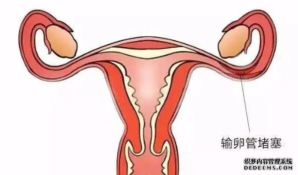 试管进周为什么要选择在经期的第二天？这样做有什么讲究吗？