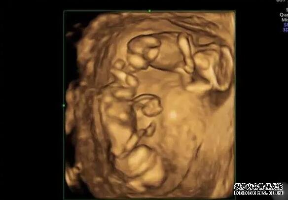 生化妊娠不会影响女性的生育能力,隔月怀孕的例子也有很多