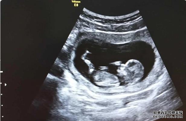 深圳失独代孕机构 2022北京大学深圳医院可以做第三代试管婴儿生男孩吗？ ‘四维彩超报告可以看出是男是女’