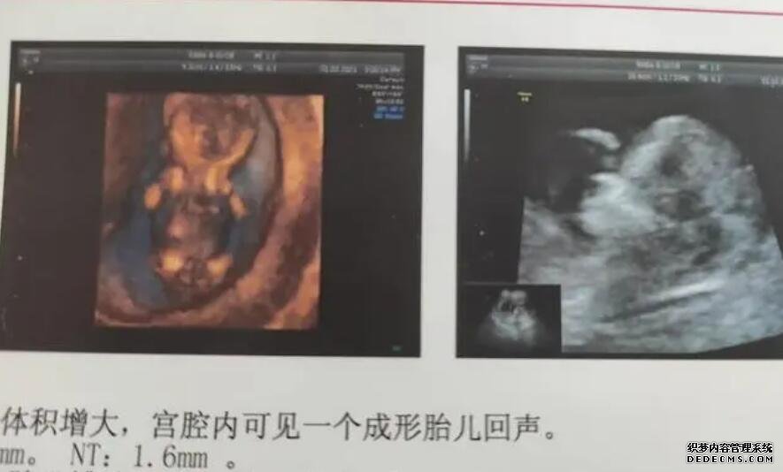 南京代孕♧◊ 当地姐妹说说做试管选南京鼓楼医院和江苏省人医哪个好? ‘孕期男孩彩超图’