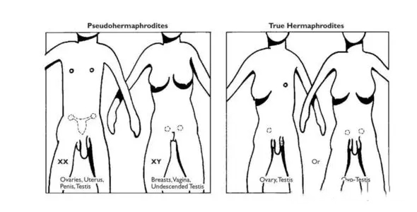 洛阳供卵试管 2023洛阳试管费用纳入医保了吗? ‘b超查男女会不会把脐带看成是男孩’